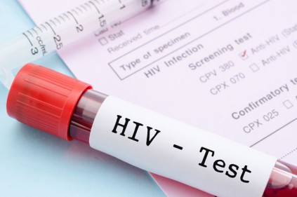 A huge number of HIV recorded in the Czech Republic
